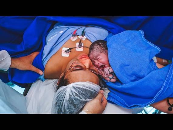 Parto Cesárea de Nascimento Betina