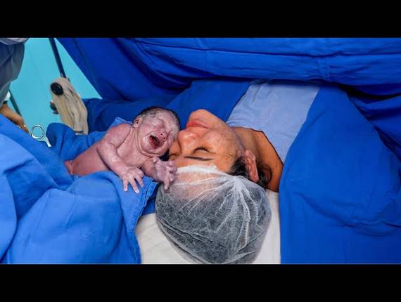 Parto Cesárea de Nascimento Bernardo