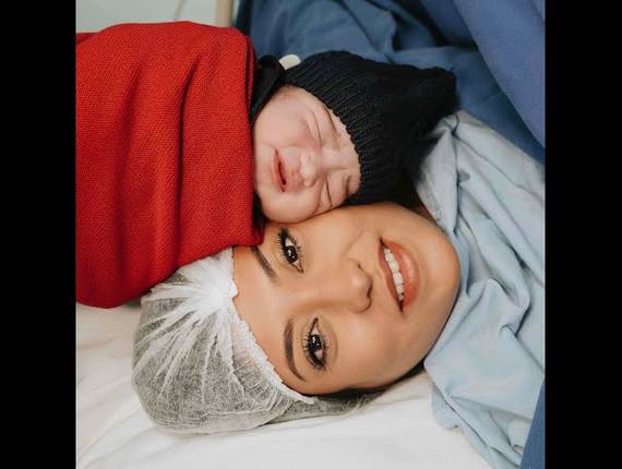 Parto Cesárea de Nascimento Miguel 