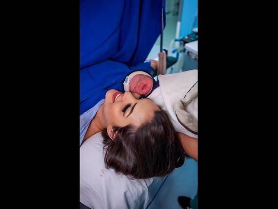 Parto Cesárea de Nascimento Bernardo