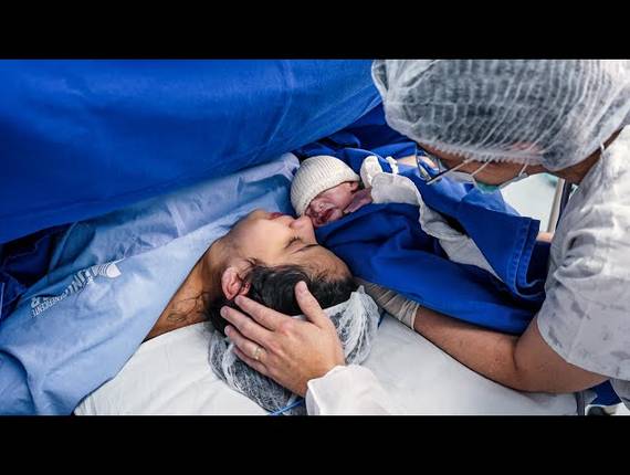 Parto Cesárea de Nascimento Fernando