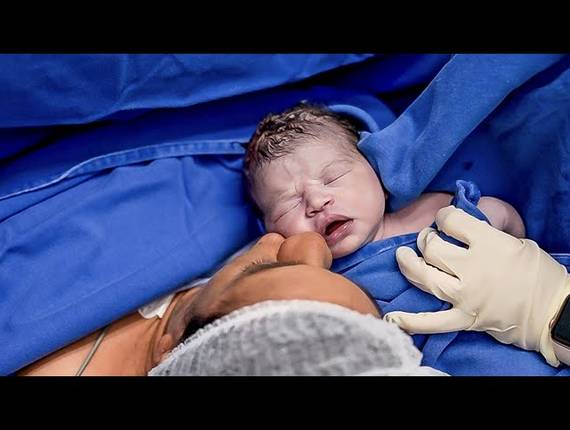 Parto Cesárea de Nascimento Maria Raquel 