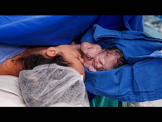 Parto Cesárea de Nascimento Alice 