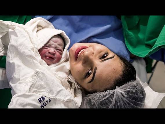 Parto Cesárea de Nascimento Ágatha 