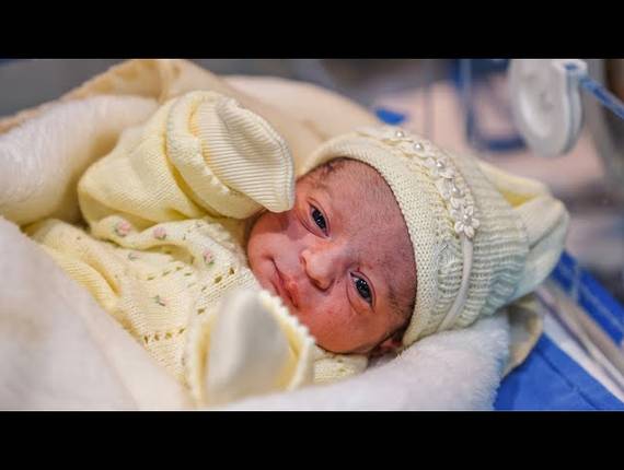 Parto Cesárea de Nascimento Isabela 