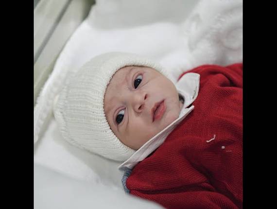 Parto Cesárea de Nascimento Bernardo