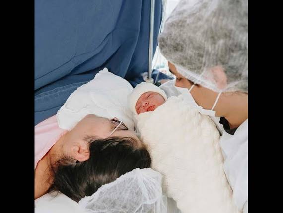 Parto Cesárea de Nascimento Ester