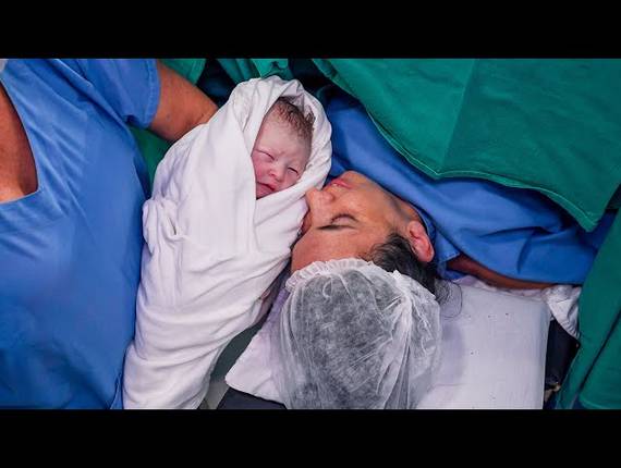 Parto Cesárea de Nascimento Isabela