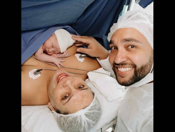 Parto Cesárea de Nascimento Lívia