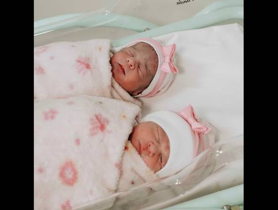 Parto Cesárea de Nascimento Ana Beatriz e Ana Liz