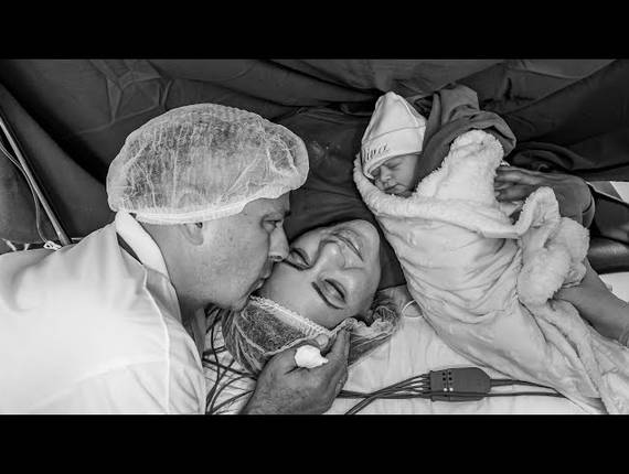 Parto Cesárea de Nascimento Melina