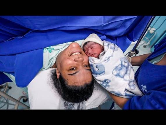 Parto Cesárea de Nascimento Joaquim