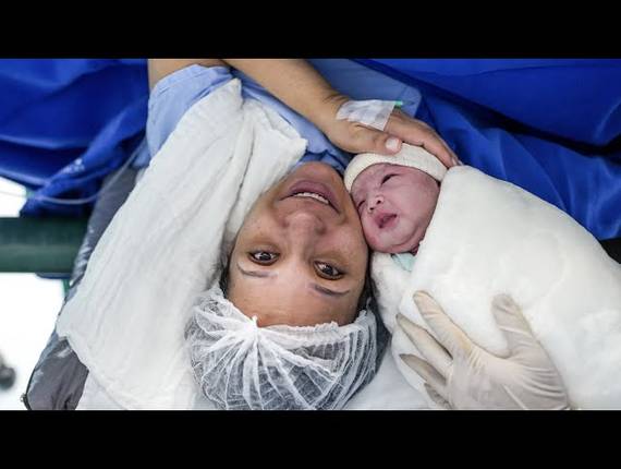 Parto Cesárea de Nascimento Sara