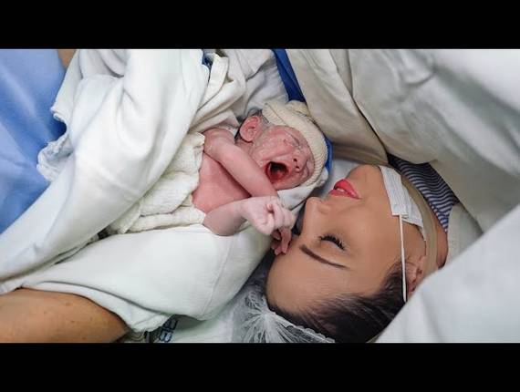 Parto Cesárea de Nascimento Manuella