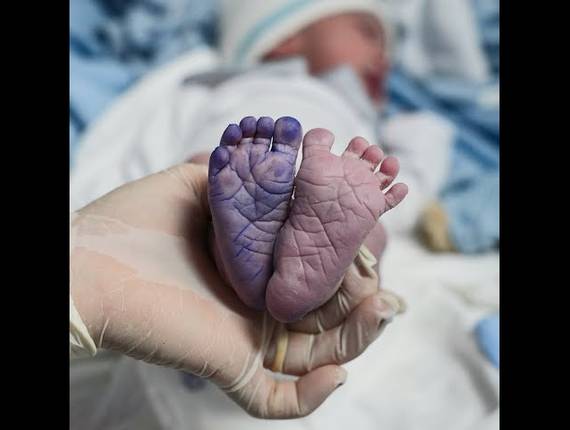 Parto Cesárea de Nascimento Leo