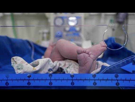 Parto Cesárea de Nascimento Murilo