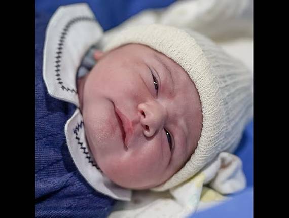 Parto Cesárea de Nascimento Pietro