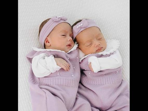 Parto Cesárea de Nascimento Ester e Estela