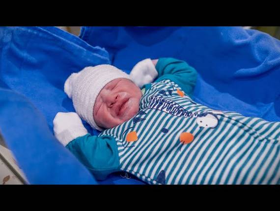 Parto Cesárea de Nascimento João Guilherme 