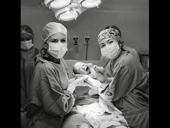 Parto Cesárea de Nascimento Alice