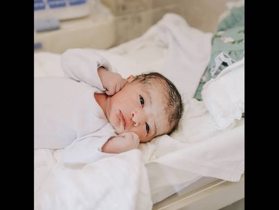 Parto Cesárea de Nascimento Acsa