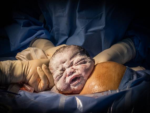 Parto  de A chega de Helena 