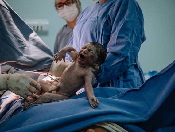 PARTOS de Cobertura de Parto da Wilma