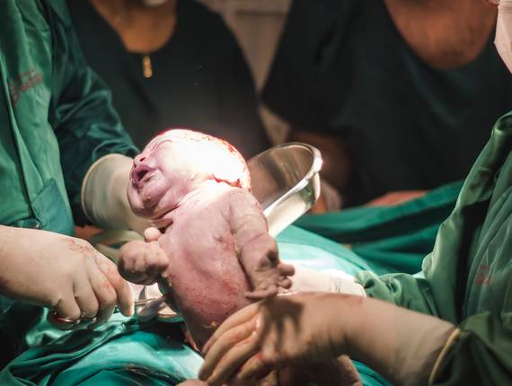 PARTOS de NASCIMENTO DO FELIPE