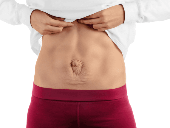 Fisioterapia Obstétrica de Reabilitação Abdominal e Diástase