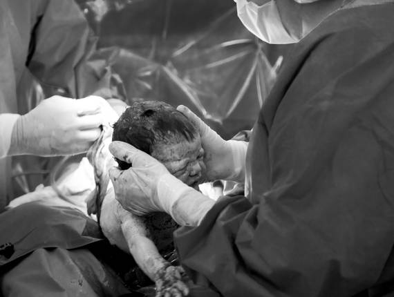 Parto de nascimento malu