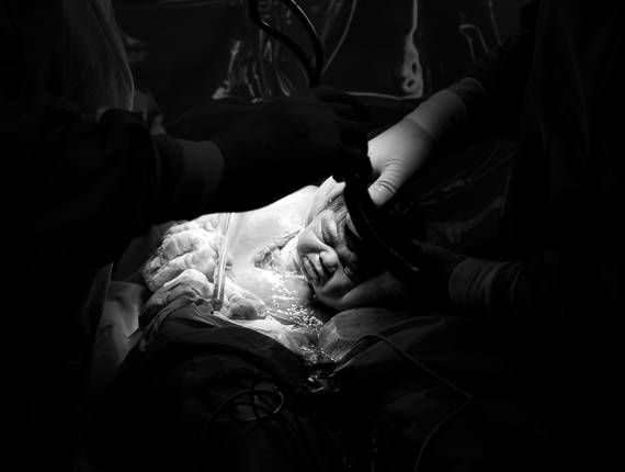 Parto de Nascimento João Lucas