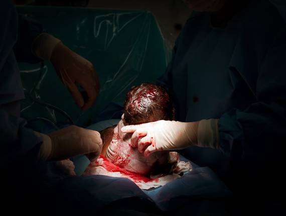 Parto de Nascimento Cecília