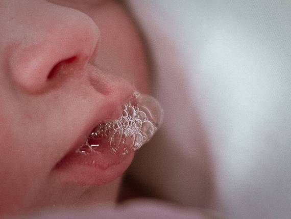 Parto de Nascimento Lucas