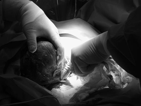 Partos de Parto • Alice