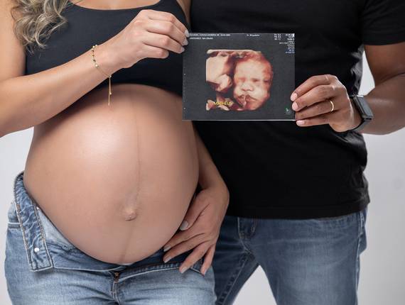 Gestantes de Karina • 35 semanas