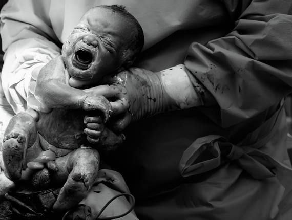 Partos de Parto • Lucca