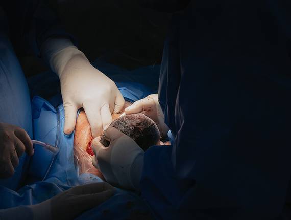 Partos de Parto • Bernardo