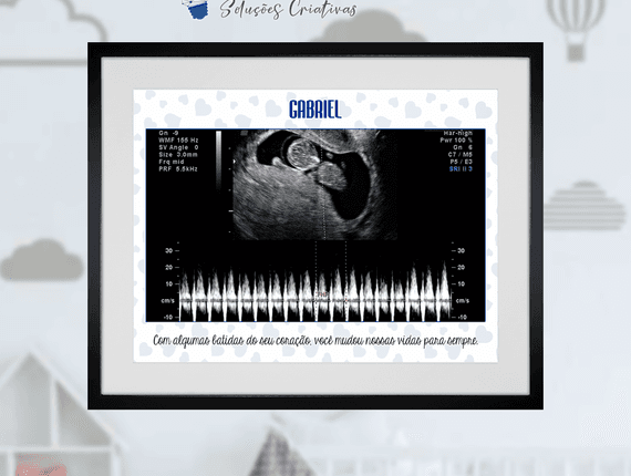 Quadros Temáticos de Batidas do Coração