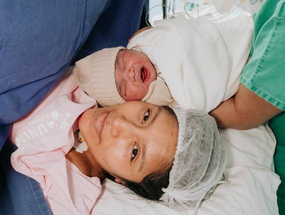 Parto Cesárea de Nascimento Tomás