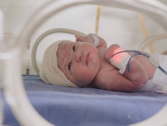 Parto Cesárea de Nascimento Liz