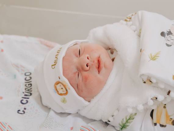 Parto Cesárea de Nascimento Isaac