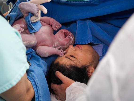 Parto Cesárea de  Nascimento Helena