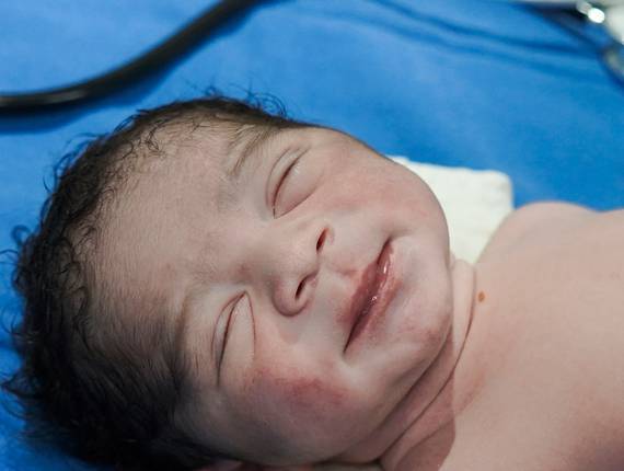 Parto Cesárea de Nascimento Miguel 