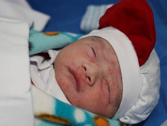 Parto Cesárea de Nascimento Arthur Leonardo