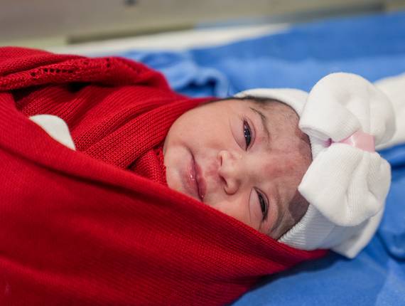 Parto Cesárea de Nascimento Melissa