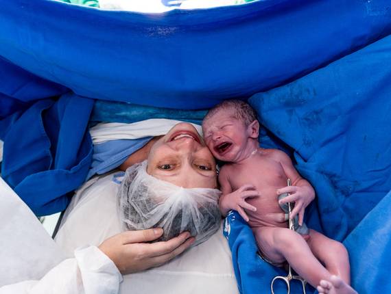 Parto Cesárea de Nascimento Bernardo