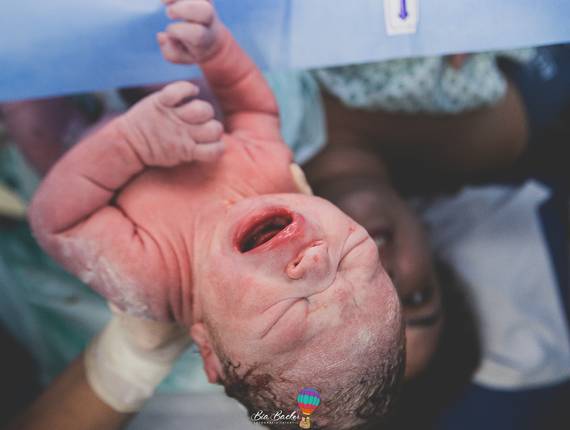 Nascimento de Fotografia de Parto RJ - Hospital Pasteur RJ - O Nascimento do Miguel