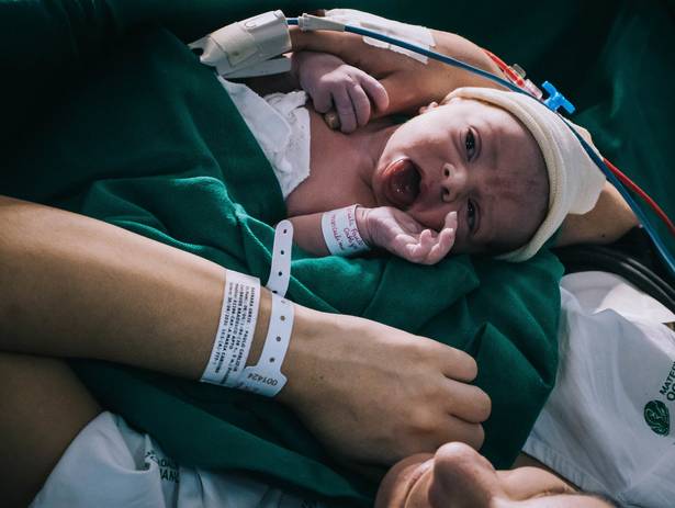 Parto de Fotografia de parto - nascimento Bernardo