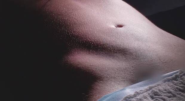 Medicina de Dra Camila Abreu | Lipo de Média Definição + Lipoenxertia no Glúteo