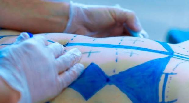 Medicina de Lipo HD - Dr. Hedelberto